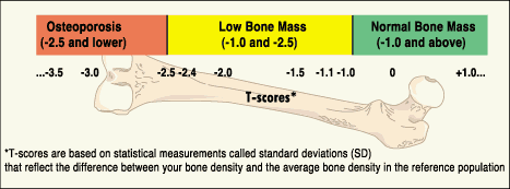 Bone Density Chart By Age